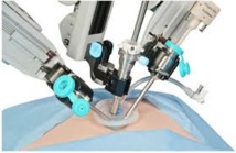 La grande invasion de la chirurgie "mini-invasive"