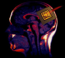 Progrès vers un implant dans le cerveau pour restaurer la mémoire