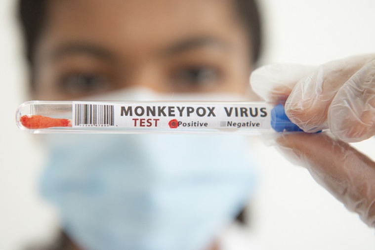 (c) Joao Luiz Bulcao / Hans Lucas / Hans Lucas via AFP (c) Joao Luiz Bulcao / Hans Lucas / Hans Lucas via AFP