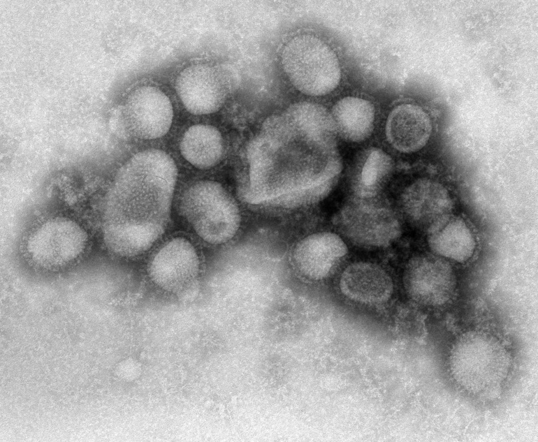 Des chercheurs créent des virus de la grippe H1N1 échappant au système immunitaire Des chercheurs créent des virus de la grippe H1N1 échappant au système immunitaire