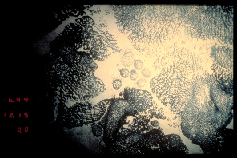 exemple d'encroutement cobaltifere (image Ifremer) exemple d'encroutement cobaltifere (image Ifremer)