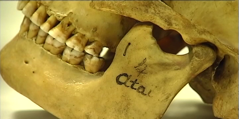 Le crâne d'Ataï, rebelle kanak décapité en 1878, va être restitué le 28 août Le crâne d'Ataï, rebelle kanak décapité en 1878, va être restitué le 28 août