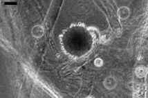 Des scientifiques argentins découvrent un champignon anti-chikungunya Des scientifiques argentins découvrent un champignon anti-chikungunya