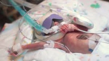 Les parents d'un grand prématuré refusent l'acharnement thérapeutique
