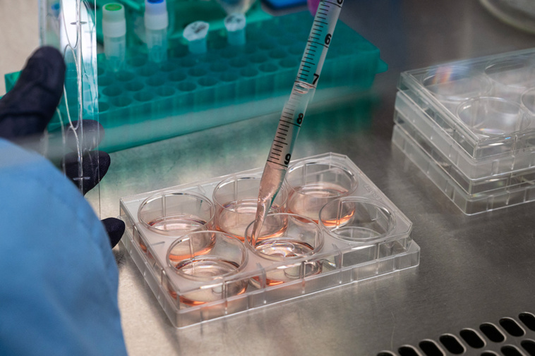 Crédit PATRICK HERTZOG / AFP Crédit PATRICK HERTZOG / AFP