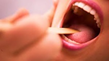 Tabac et sexe oral accroîtraient le risque de cancers buccaux