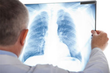 Journée mondiale contre les broncho-pneumopathies chroniques obstructives