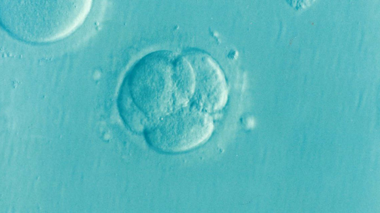 L'infertilité touche une personne sur six selon l'OMS