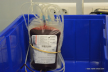 Une poche de sang, juste après un don : il faut compter 45' à une heure le temps complet du don du sang avec le remplissage du questionnaire, l'entretien avec le taote, le prélèvement du sang et la collation.