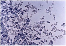 Des spores de Colletotrichum gloeosporioides forma specialis Miconiae (source Killgore et al., 1997, Miconia Conference CGM)