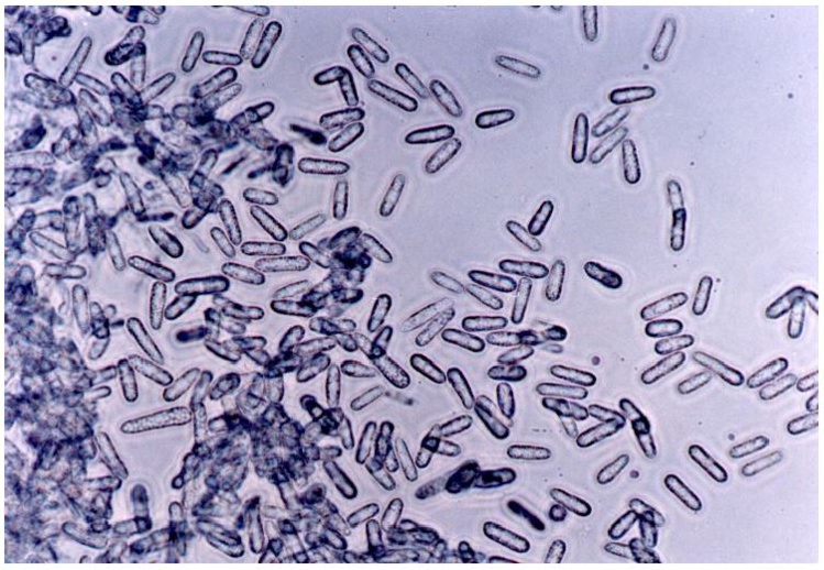 Des spores de C G miconiae (source Killgore et al 1997)
