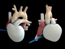 Coeur artificiel : le deuxième patient se "sent revivre" et fait du vélo
