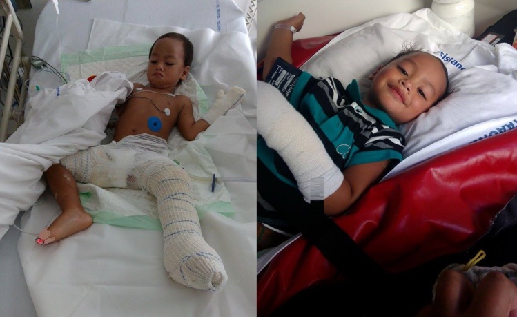 Tehaunui, 2 ans, gravement brûlé, est arrivé en Nouvelle-Zélande