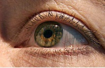 De l'astuce et du basilic pour extraire une larve de l'œil d'un Péruvien De l'astuce et du basilic pour extraire une larve de l'œil d'un Péruvien