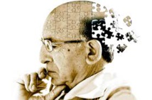 Un traitement expérimental contre Alzheimer donne des résultats prometteurs