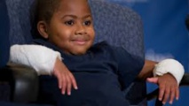 Un enfant de huit ans devient le plus jeune greffé des deux mains
