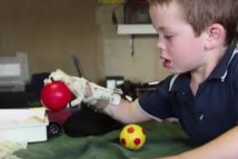 L'impression 3D veut donner une main aux enfants qui n'en ont pas