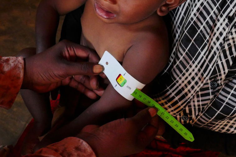 Pablo PORCIUNCULA BRUNE / AFP Pablo PORCIUNCULA BRUNE / AFP