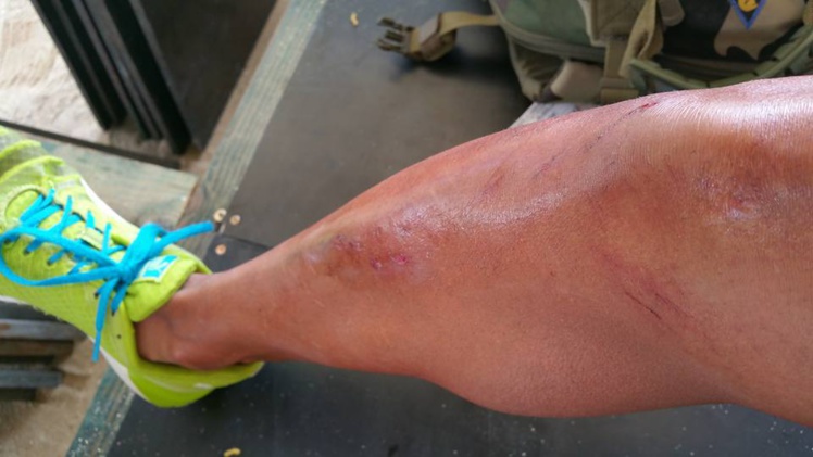 Cédric Wane est tombé plusieurs fois Cédric Wane est tombé plusieurs fois