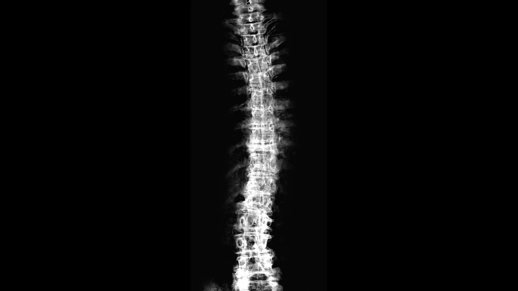Une semaine pour prendre soin de sa colonne vertébrale Une semaine pour prendre soin de sa colonne vertébrale