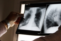 Pour dépister une tuberculose deux examens sont prescrits : un test cutané et une radio des poumons. Mais en Polynésie française, l'examen radiographique est à la charge du patient. Ce qui explique que le protocole médical des proches d'un malade est peu suivi jusqu'à son terme .