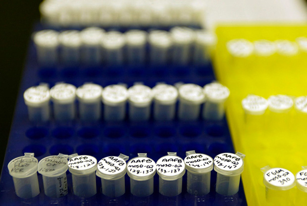 Des cas autochtones de fièvre "West-Nile" en Île-de-France, du jamais vu