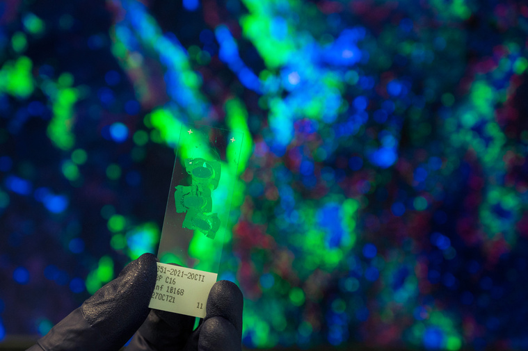 PATRICK HERTZOG / AFP PATRICK HERTZOG / AFP