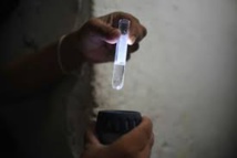 Une étude sur des souris décrypte la transmission du Zika de la mère au foetus Une étude sur des souris décrypte la transmission du Zika de la mère au foetus