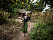 Assassinats d'albinos: le Malawi interdit les sorciers et guérisseurs traditionnels