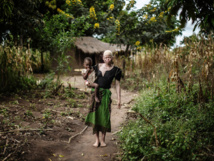 Assassinats d'albinos: le Malawi interdit les sorciers et guérisseurs traditionnels Assassinats d'albinos: le Malawi interdit les sorciers et guérisseurs traditionnels