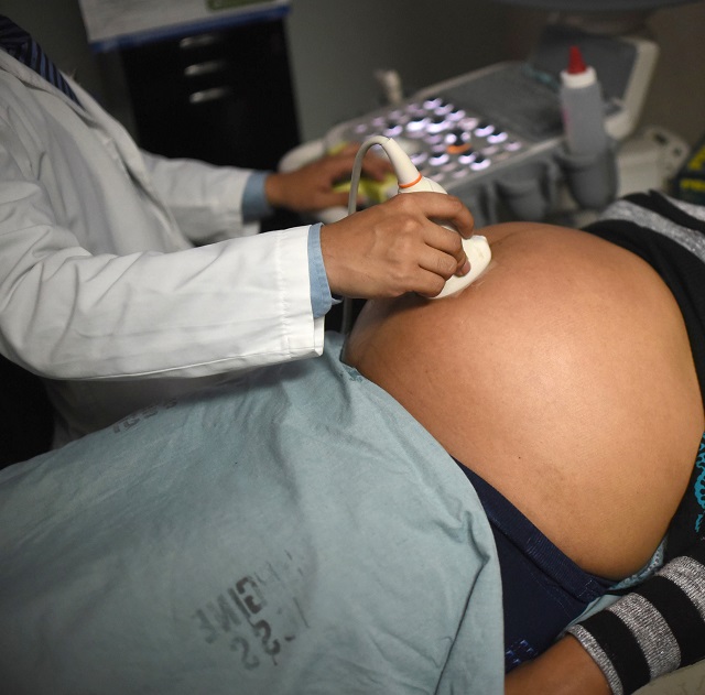 Trisomie 21: le test génétique non invasif préconisé à la place des amniocentèses