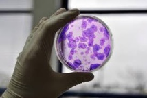 USA: 570 cliniques proposent des soins non-autorisés avec des cellules souches