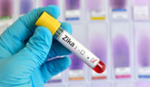 Canada: un vaccin anti-Zika testé pour la première fois sur l'homme