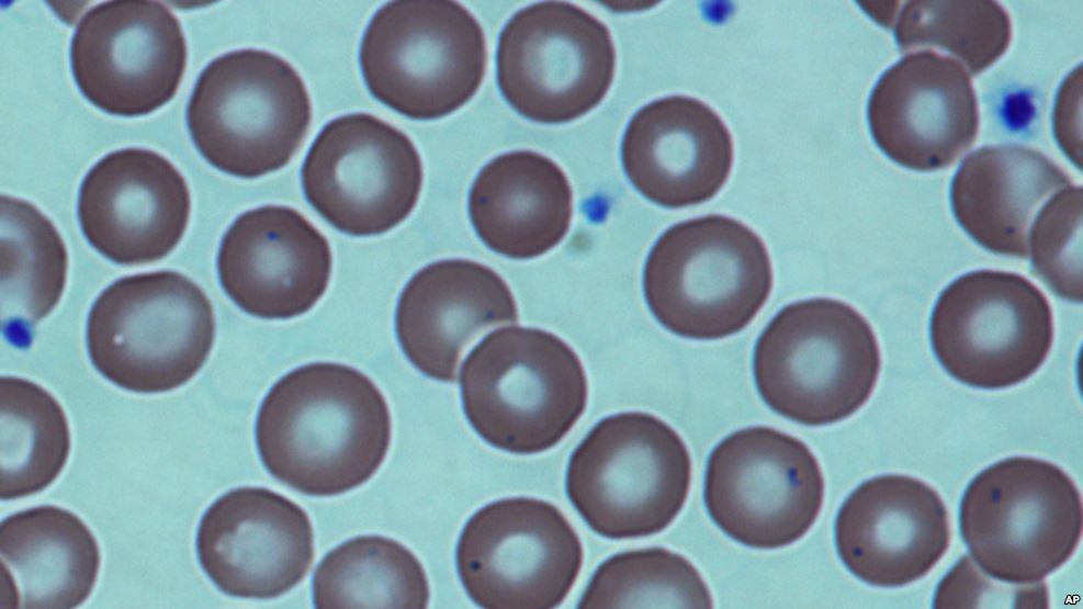 Bientôt des greffes de moelle osseuse sans chimiothérapie, moins dangereuses
