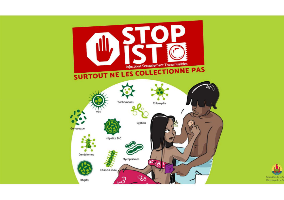 Où trouver des préservatifs gratuitement