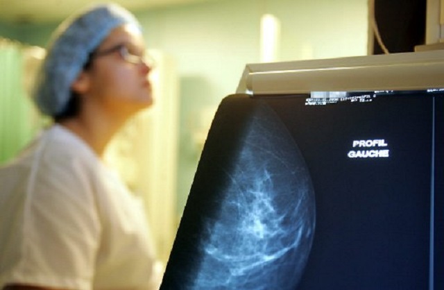C'est à partir de 50 ans que le risque de développer un cancer du sein est le plus important. Photo : AFP