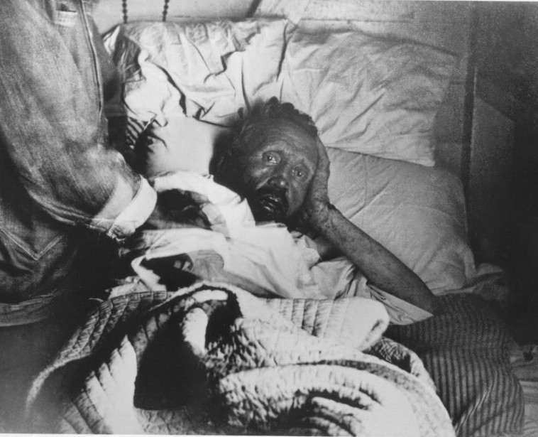 Le père Damien sur son lit de mort, amaigri, épuisé, son oreille droite rongée par la lèpre. Il sait qu’il ne se relèvera plus. Il a 49 ans et semble à la fois terrorisé et affligé.