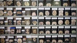 Au Pérou, un musée pour scruter les cerveaux malades