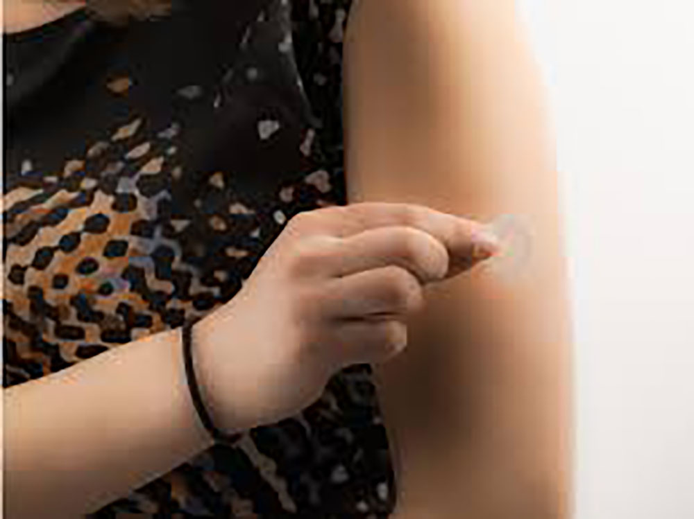 Patch prometteur contre l'allergie à l'arachide et à d'autres aliments