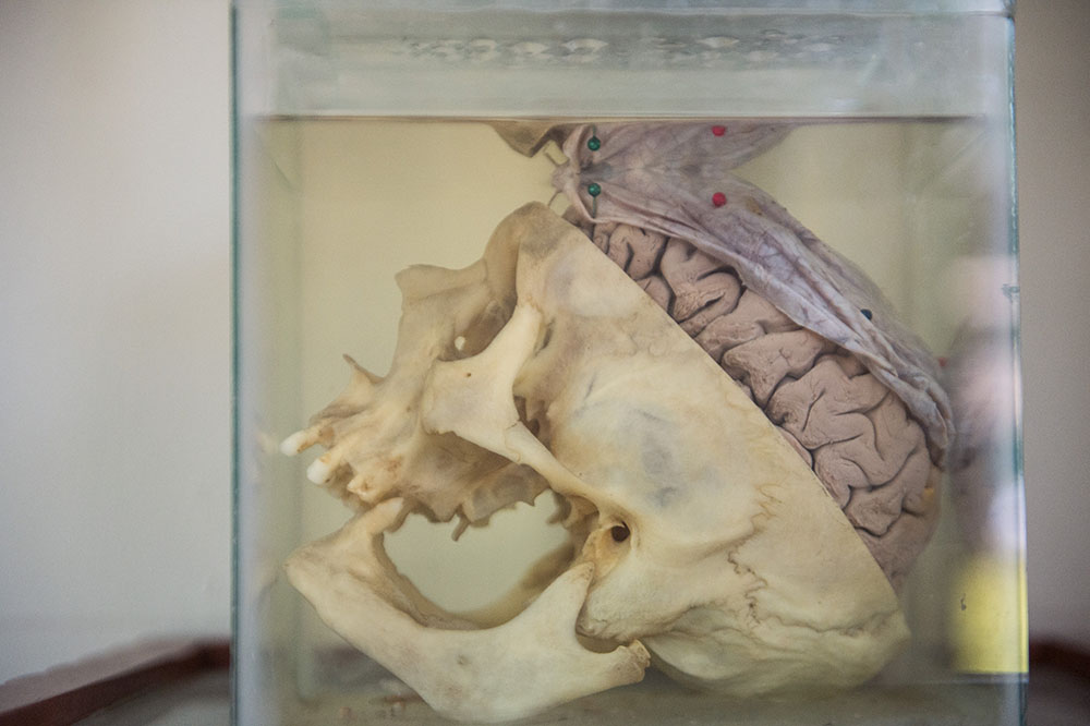 Cerveau : une semaine pour faire le point sur des recherches en plein essor