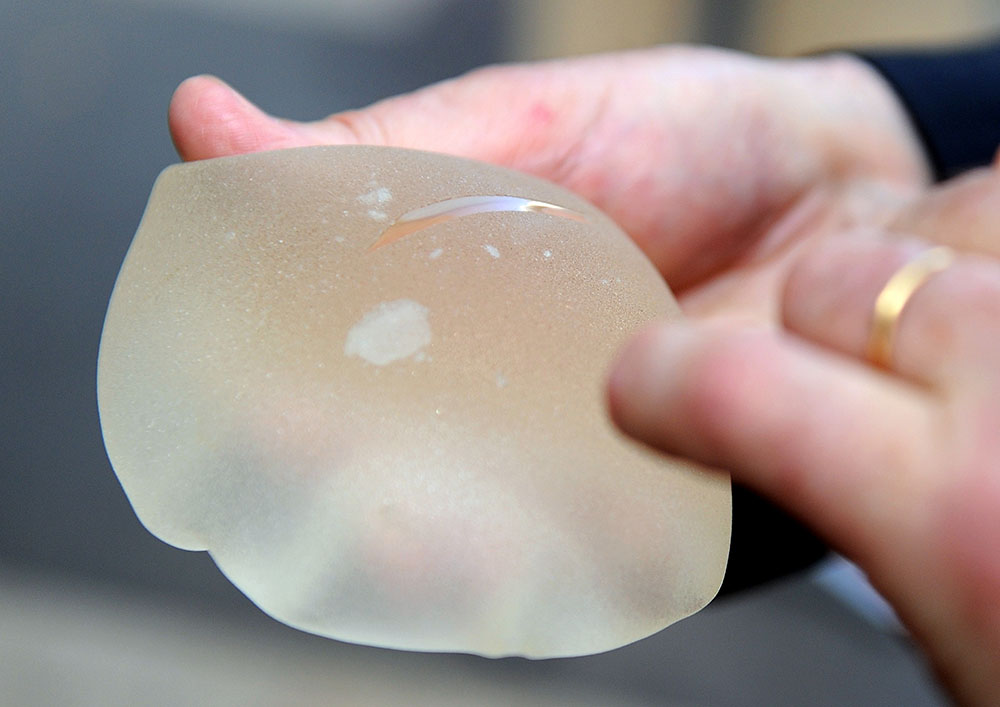 Prothèses PIP: le certificateur TÜV n'obtient pas de délai pour indemniser les plaignantes