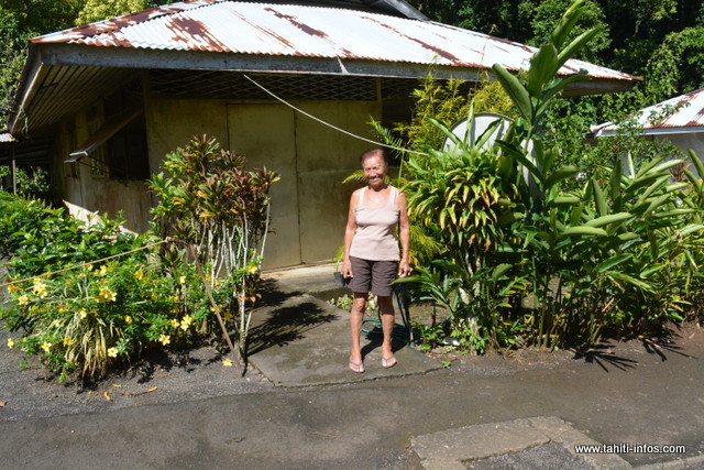 Cécile, 79 ans est arrivée à Orofara, en 1960. Elle a contracté la maladie, alors qu'elle n'avait que 19 ans.