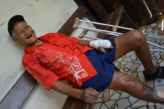 Cécile, ancienne malade de la lèpre : "Mes parents m'ont mise de côté" 