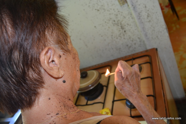 Insensibles à la douleur, les lépreux ne sentent pas quand ils se brûlent.