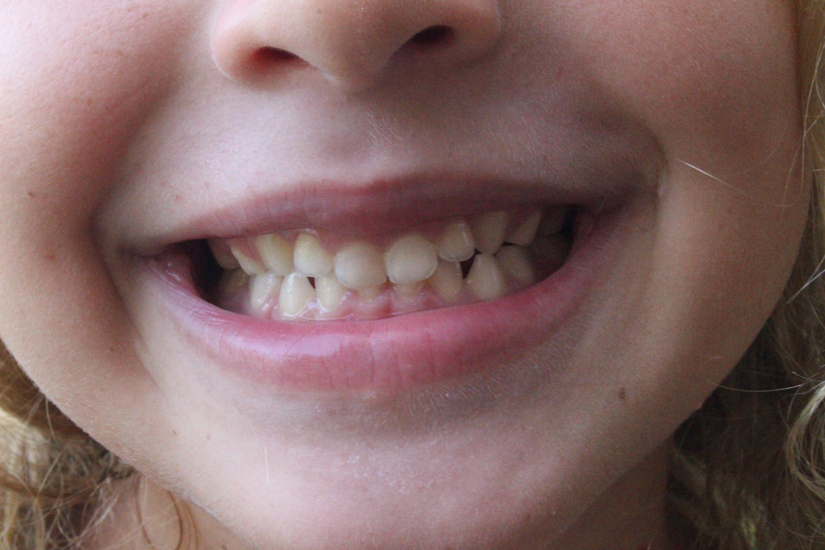 Journal des enfants : Tout savoir sur les dents, organe vivant de la dentition