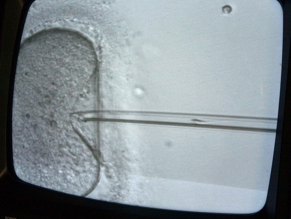 Un autre couple a porté leur enfant: une famille californienne attaque une clinique en justice