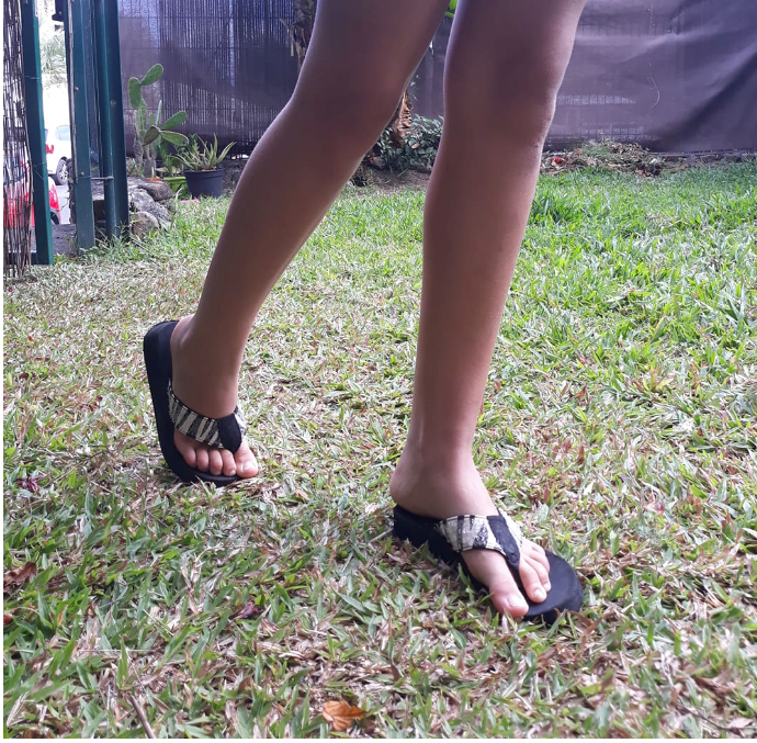 Le port prolongé des savates peut parfois provoquer des problèmes de santé.