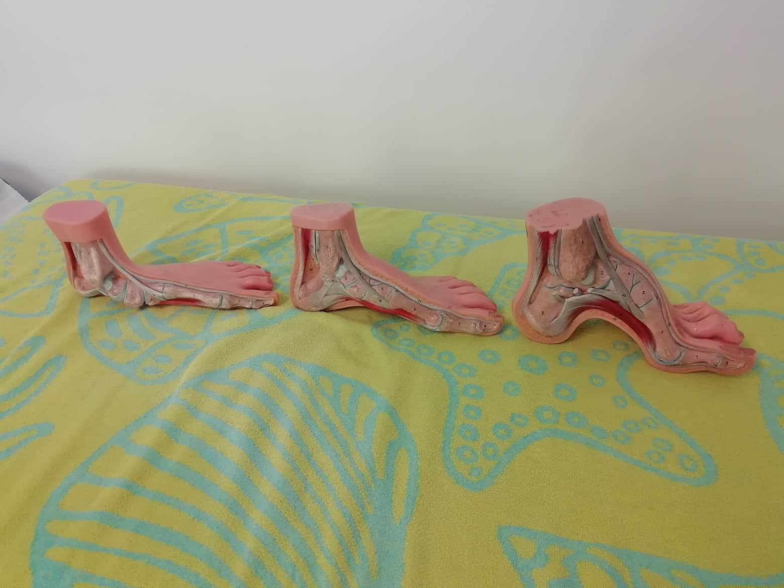 Les savates, c'est pas toujours le pied !