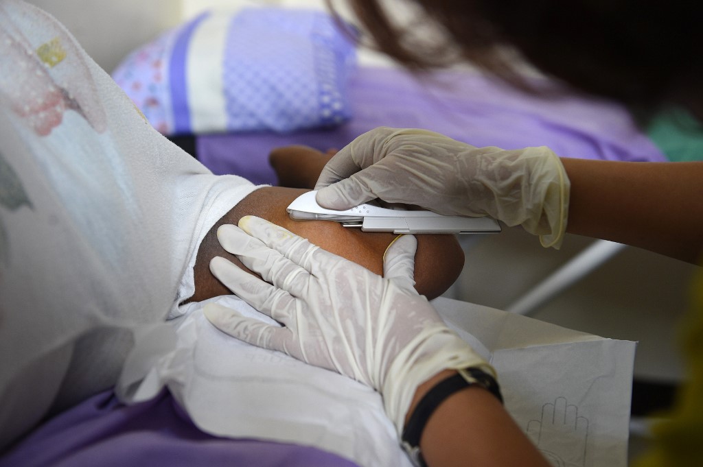 Une association alerte après deux cas d'implants contraceptifs dans les poumons