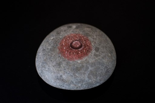 Diagnostic du cancer du sein : l'intelligence artificielle peut faire mieux que l'humain